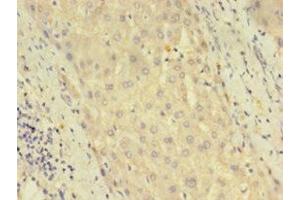 Immunohistochemistry of paraffin-embedded human liver tissue using ABIN7150765 at dilution of 1:100 (DUSP26 anticorps  (AA 1-211))