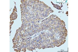 IHC analysis of Neurofibromin/NF1 using anti-Neurofibromin/NF1 antibody (ABIN7600197). (Neurofibromin 1 anticorps  (AA 160-270))