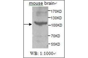 Western Blotting (WB) image for anti-tyrosine Kinase, Non-Receptor, 2 (TNK2) (AA 278-289) antibody (ABIN955283) (TNK2 anticorps  (AA 278-289))