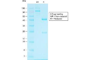 SDS-PAGE Analysis of Purified Glypican-3 Rabbit Recombinant Monoclonal Antibody (GPC3/1534R).