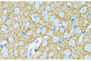 Immunohistochemistry of paraffin-embedded Rat brain using SYP Polyclonal Antibody at dilution of 1:100 (40x lens).