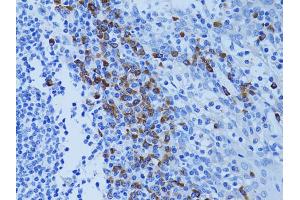 Immunohistochemistry of paraffin-embedded human tonsil using ATG7 antibody (ABIN5970265) at dilution of 1/100 (40x lens). (ATG7 anticorps)
