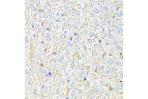 Immunohistochemistry of paraffin-embedded mouse liver using ABCA6 antibody (ABIN1870712) at dilution of 1:100 (40x lens). (ABCA6 anticorps)