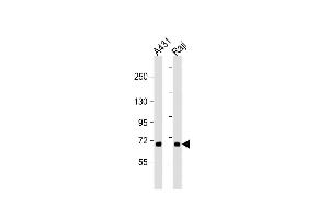 All lanes : Anti-P3K5 Antibody  at 1:2000 dilution Lane 1: A431 whole cell lysate Lane 2: Raji whole cell lysate Lysates/proteins at 20 μg per lane. (ASK1 anticorps  (AA 821-849))