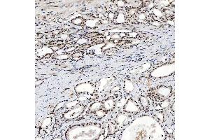 IHC analysis of SNRNP200 using anti-SNRNP200 antibody (ABIN7602032).