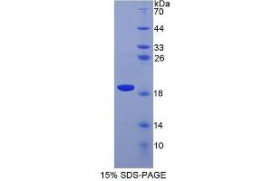 Image no. 1 for Superoxide Dismutase 1, Soluble (SOD1) (AA 2-154) protein (His tag) (ABIN1171401) (SOD1 Protein (AA 2-154) (His tag))
