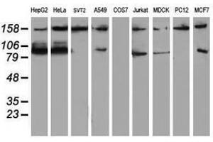 Image no. 4 for anti-ATR Interacting Protein (ATRIP) (AA 42-309) antibody (ABIN1491507)