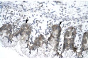 Human Stomach; IVNS1ABP antibody - N-terminal region in Human Stomach cells using Immunohistochemistry (IVNS1ABP anticorps  (N-Term))