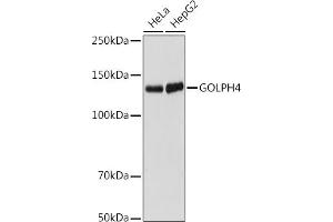 Western blot analysis of extracts of various cell lines, using GOLPH4 antibody (ABIN7267488) at 1:1000 dilution. (Golgi Integral Membrane Protein 4 (GOLIM4) anticorps)