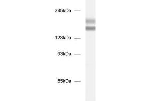 dilution: 1 : 1000, sample: mouse brain homogenate (Tenascin R anticorps)