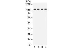 Western blot testing of human 1) HeLa, 2) Jurkat, 3) SKOV and 4) mouse kidney lysate with SLC12A1 antibody. (SLC12A1 anticorps)
