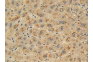 Used in DAB staining on fromalin fixed paraffin-embedded Liver tissue (FKBP1B anticorps  (AA 2-108))