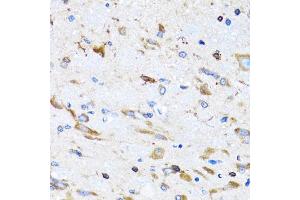 Immunohistochemistry of paraffin-embedded mouse spinal cord using PTRH2 antibody (ABIN5973864) at dilution of 1/100 (40x lens). (PTRH2 anticorps)