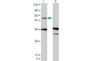 Western Blot analysis of MMP13 expression in transfected 293T cell line by MMP13 monoclonal antibody (M07), clone 3B11. (MMP13 anticorps  (AA 362-471))