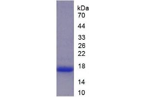 SDS-PAGE of Protein Standard from the Kit (Highly purified E. (Lactoferrin Kit CLIA)