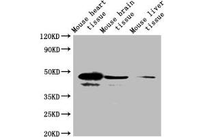 Western blot All lanes: Selenoprotein P antibody at 2 μg/mL + Mouse heart tissue Secondary Goat polyclonal to rabbit IgG at 1/10000 dilution Predicted band size: 43 kDa Observed band size: 43 kDa (Selenoprotein P (SELENOP) (AA 20-381) anticorps)