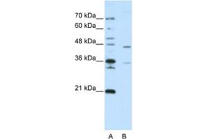 WB Suggested Anti-ZNF488 Antibody Titration:  2. (ZNF488 anticorps  (C-Term))