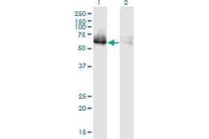 Western Blot analysis of ZNF35 expression in transfected 293T cell line by ZNF35 monoclonal antibody (M03), clone 2B4. (ZNF35 anticorps  (AA 1-519))