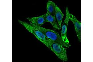 Immunofluorescence analysis of HepG2 cells using ARHGDIA antibody (green).