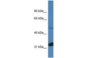 Image no. 1 for anti-Protein Phosphatase 2, Regulatory Subunit B, delta (PPP2R2D) (AA 380-429) antibody (ABIN6746439) (PPP2R2D anticorps  (AA 380-429))