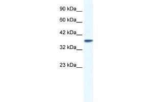 WB Suggested Anti-KCNK3 Antibody Titration:  1.