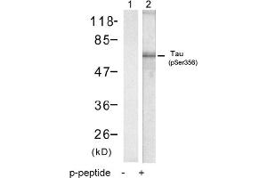 Image no. 1 for anti-Microtubule-Associated Protein tau (MAPT) (pSer356) antibody (ABIN319220) (MAPT anticorps  (pSer356))