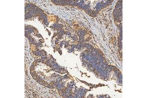 IHC analysis of SEC23IP using anti-SEC23IP antibody (ABIN7601222).