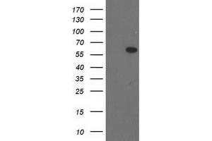 Western Blotting (WB) image for anti-BAI1-Associated Protein 2 (BAIAP2) antibody (ABIN1496807) (BAIAP2 anticorps)