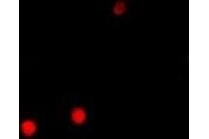 Immunofluorescent analysis of PRDM14 staining in A549 cells.