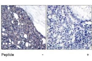 Image no. 1 for anti-Nuclear Factor of kappa Light Polypeptide Gene Enhancer in B-Cells Inhibitor, alpha (NFKBIA) (Tyr42) antibody (ABIN197391) (NFKBIA anticorps  (Tyr42))