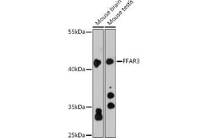 anti-Free Fatty Acid Receptor 3 (FFAR3) (AA 257-346) antibody