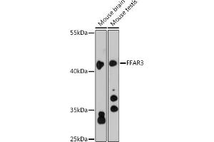 Western blot analysis of extracts of various cell lines, using FF antibody (ABIN6129724, ABIN6140586, ABIN6140587 and ABIN6216341) at 1:3000 dilution. (FFAR3 anticorps  (AA 257-346))