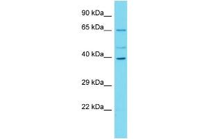 Western Blotting (WB) image for anti-Chromosome 16 Open Reading Frame 59 (C16ORF59) (N-Term) antibody (ABIN2791199) (C16ORF59 anticorps  (N-Term))