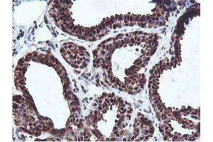 Immunohistochemical staining of paraffin-embedded Human breast tissue using anti-PSMB7 mouse monoclonal antibody.
