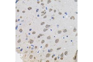 Immunohistochemistry of paraffin-embedded rat brain using VEPH1 antibody. (VEPH1 anticorps  (AA 448-547))