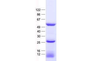 Validation with Western Blot