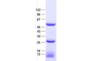 Validation with Western Blot (TRMT12 Protein (His tag))