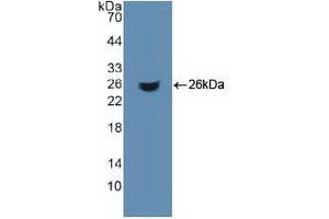 Detection of Recombinant ACO1, Human using Polyclonal Antibody to Aconitase 1 (ACO1) (Aconitase 1 anticorps  (AA 26-243))