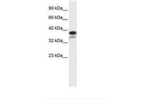Image no. 1 for anti-Poly (ADP-Ribose) Polymerase Family, Member 6 (PARP6) (AA 72-121) antibody (ABIN202705) (PARP6 anticorps  (AA 72-121))