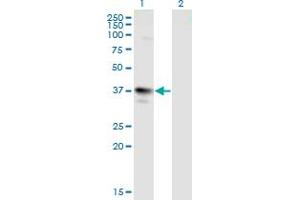 Western Blot analysis of MAGEA3 expression in transfected 293T cell line by MAGEA3 monoclonal antibody (M01), clone 6D10. (MAGEA3 anticorps  (AA 44-114))