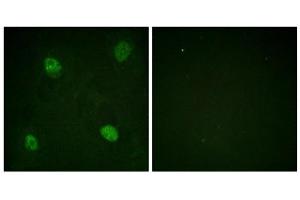 Immunofluorescence analysis of HeLa cells, using hnRPD (Phospho-Ser83) antibody. (HNRNPD/AUF1 anticorps  (pSer83))