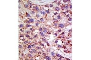 Image no. 1 for anti-Ubiquitin Specific Peptidase 11 (USP11) (N-Term) antibody (ABIN357538)