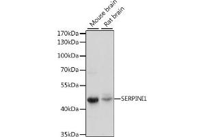 Western blot analysis of extracts of various cell lines, using SERPINI1 antibody (ABIN7270251) at 1:1000 dilution.