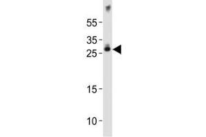 Western blot analysis of lysate from mouse brain tissue lysate using Olig1 antibody diluted at 1:1000.