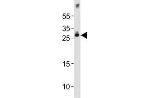 Western blot analysis of lysate from mouse brain tissue lysate using Olig1 antibody diluted at 1:1000. (OLIG1 anticorps  (AA 161-194))