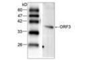 Image no. 1 for anti-Hepatitis E Virus (HEV) (AA 34-123) antibody (ABIN791327) (Hepatitis E Virus anticorps  (AA 34-123))