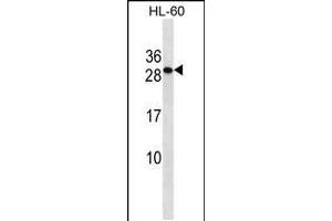 Western blot analysis in HL-60 cell line lysates (35ug/lane). (TMED6 anticorps  (AA 125-153))