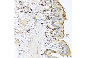 Immunohistochemistry of paraffin-embedded mouse lung using PRSS1 antibody at dilution of 1:100 (40x lens). (PRSS1 anticorps)