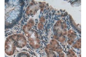 Detection of RXFP1 in Human Stomach Tissue using Polyclonal Antibody to Relaxin/Insulin Like Family Peptide Receptor 1 (RXFP1)