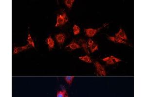 Immunofluorescence analysis of C6 cells using ADAM11 Polyclonal Antibody at dilution of 1:100. (ADAM11 anticorps)